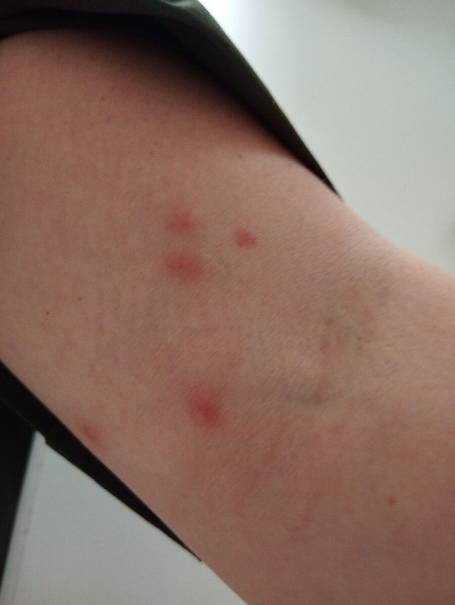 bettwanzen_bekaempfen