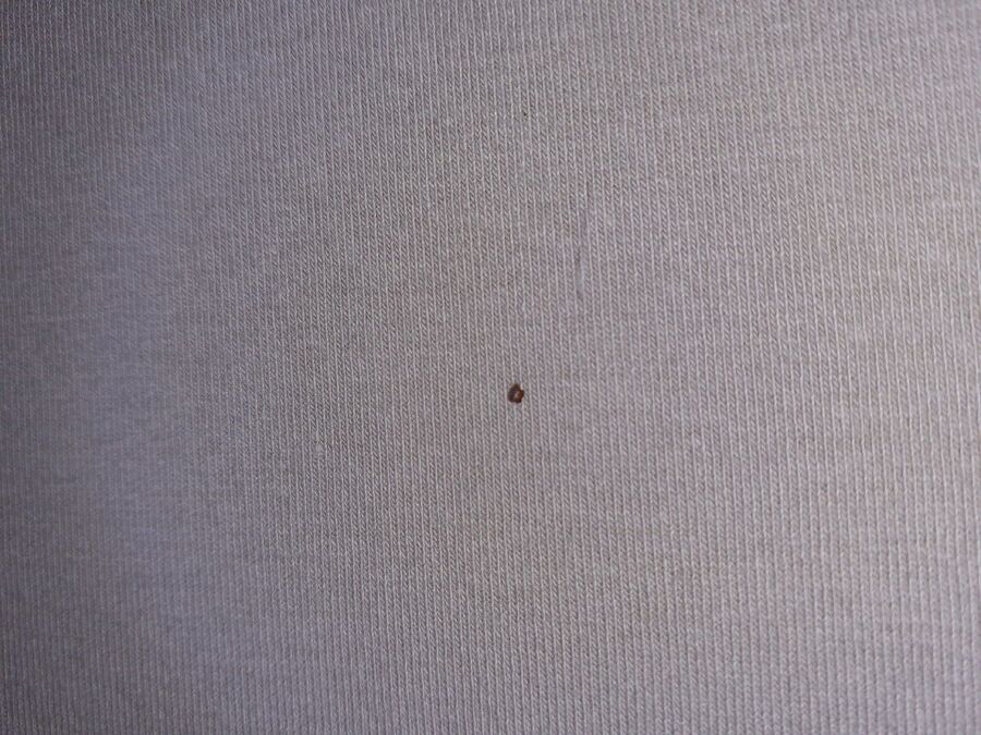 bettwanzen_bekaempfen